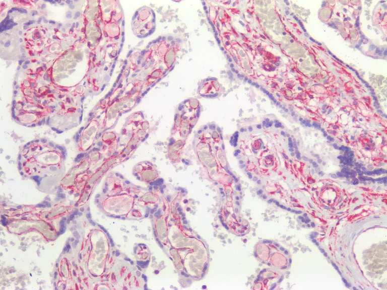 Immunohistochemistry (Formalin/PFA-fixed paraffin-embedded sections) - Anti-Vimentin antibody [RV202] - Cytoskeleton Marker (AB8978)