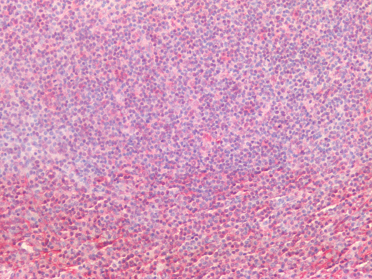 Immunohistochemistry (Formalin/PFA-fixed paraffin-embedded sections) - Anti-Vimentin antibody [RV202] - Cytoskeleton Marker (ab8978), expandable thumbnail