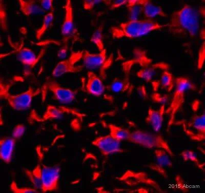 Immunohistochemistry (Formalin/PFA-fixed paraffin-embedded sections) - Anti-Vimentin antibody [RV202] - Cytoskeleton Marker (AB8978)