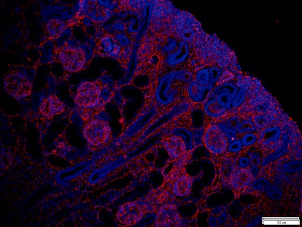 Immunohistochemistry (Formalin/PFA-fixed paraffin-embedded sections) - Anti-Vimentin antibody [RV202] - Cytoskeleton Marker (ab8978), expandable thumbnail