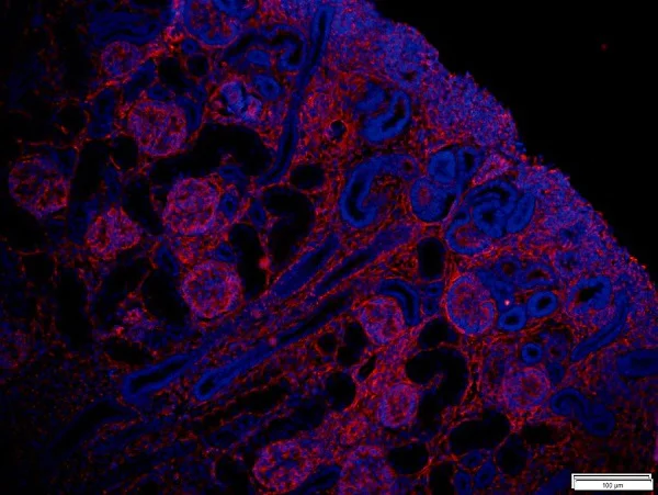 Immunohistochemistry (Formalin/PFA-fixed paraffin-embedded sections) - Anti-Vimentin antibody [RV202] - Cytoskeleton Marker (AB8978)
