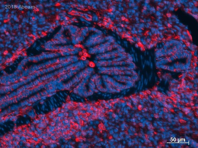 Immunohistochemistry (Formalin/PFA-fixed paraffin-embedded sections) - Anti-Vimentin antibody [RV202] - Cytoskeleton Marker (ab8978), expandable thumbnail