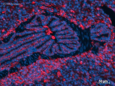 Immunohistochemistry (Formalin/PFA-fixed paraffin-embedded sections) - Anti-Vimentin antibody [RV202] - Cytoskeleton Marker (AB8978)