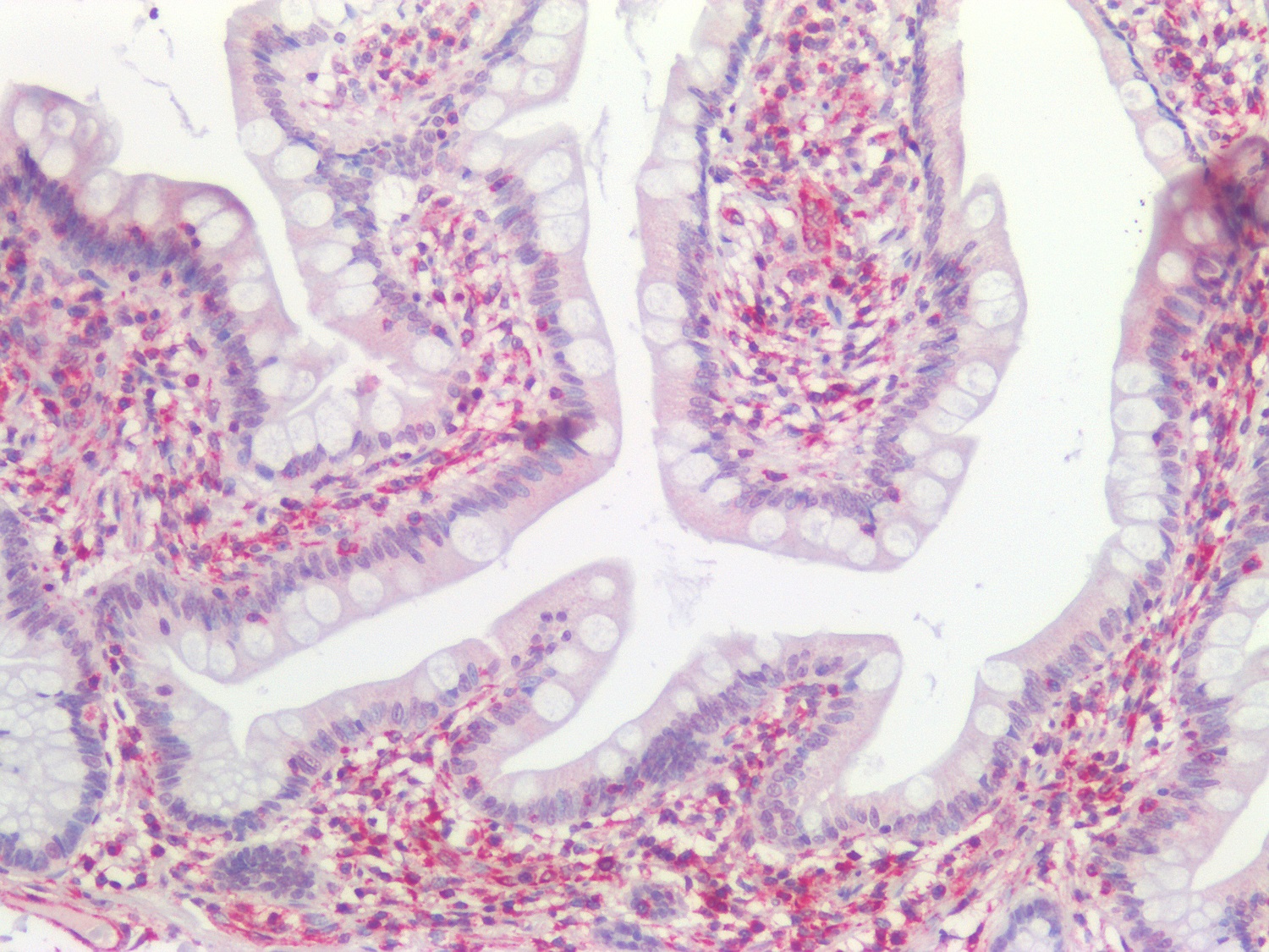 Immunohistochemistry (Formalin/PFA-fixed paraffin-embedded sections) - Anti-Vimentin antibody [RV202] - Cytoskeleton Marker (AB8978), expandable thumbnail
