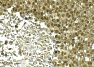 Immunohistochemistry (Frozen sections) - Anti-Vimentin antibody [RV202] - Cytoskeleton Marker (ab8978), expandable thumbnail