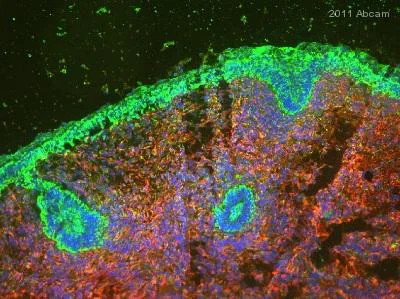 Immunohistochemistry (Frozen sections) - Anti-Vimentin antibody [RV202] - Cytoskeleton Marker (AB8978)