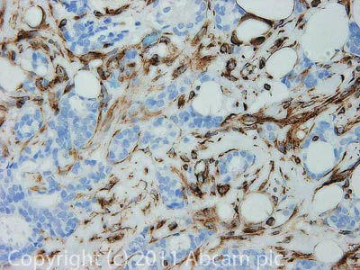 Immunohistochemistry (Formalin/PFA-fixed paraffin-embedded sections) - Anti-Vimentin antibody [RV203] (AB8979)