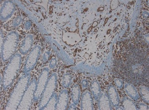 Immunohistochemistry (Formalin/PFA-fixed paraffin-embedded sections) - Anti-Vimentin antibody [RV203] (AB8979), expandable thumbnail