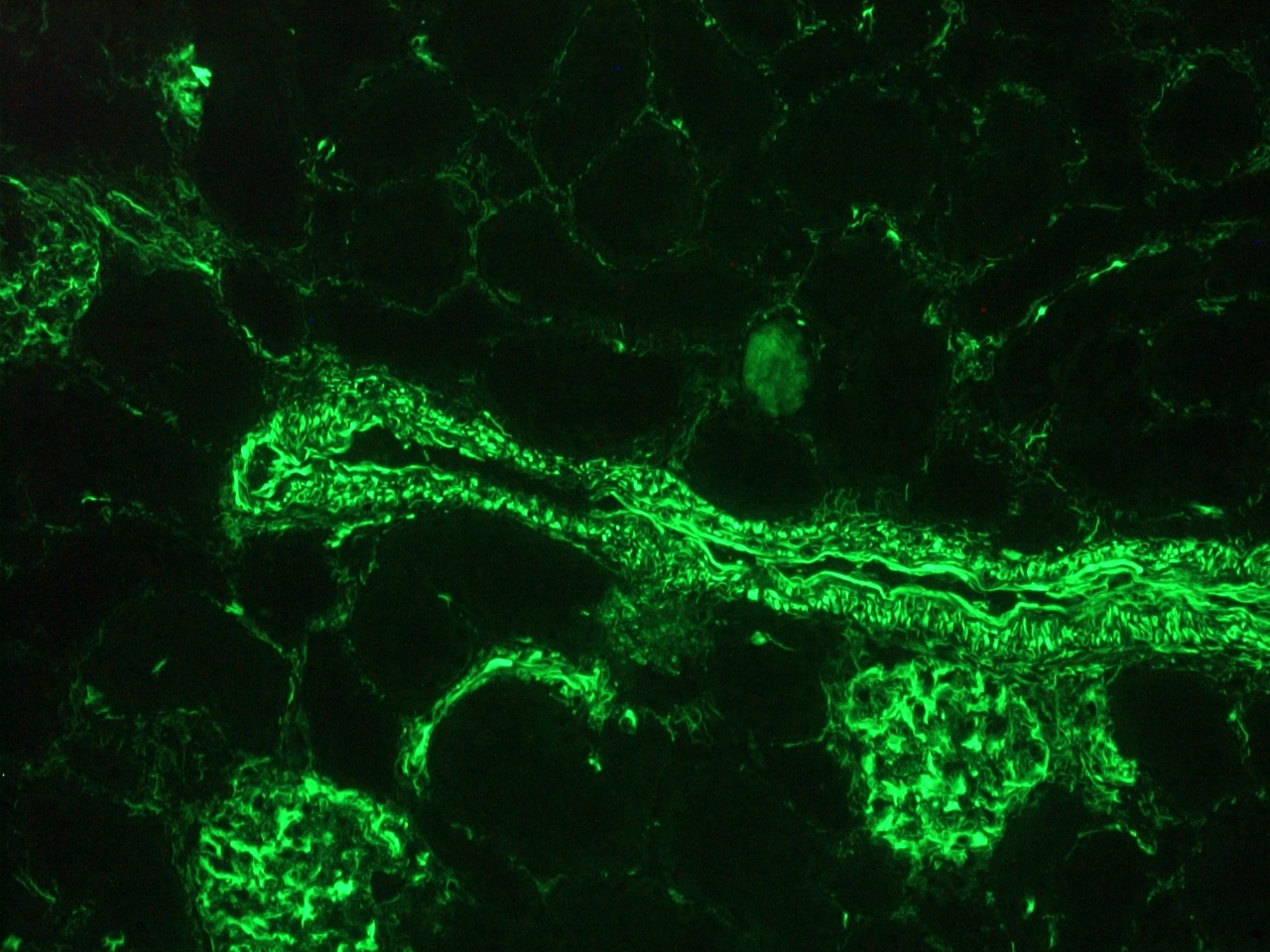 Immunohistochemistry (Frozen sections) - Anti-Vimentin antibody [RV203] (AB8979), expandable thumbnail