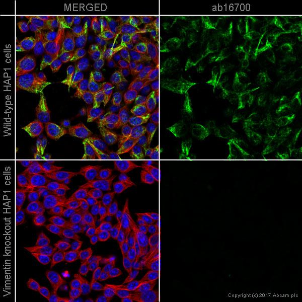 Immunocytochemistry/ Immunofluorescence - Anti-Vimentin antibody [SP20] (ab16700), expandable thumbnail