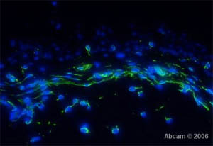 Immunocytochemistry/ Immunofluorescence - Anti-Vimentin antibody [SP20] (ab16700), expandable thumbnail