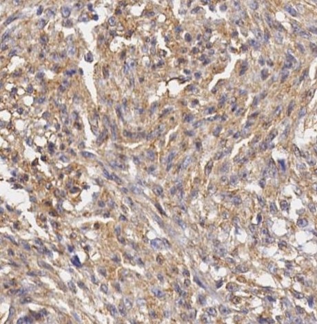 Immunohistochemistry (Formalin/PFA-fixed paraffin-embedded sections) - Anti-Vimentin antibody [SP20] (ab16700), expandable thumbnail