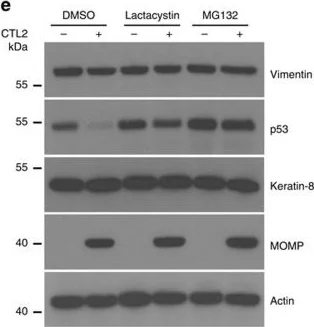 Western blot - Anti-Vimentin antibody [SP20] (AB16700)
