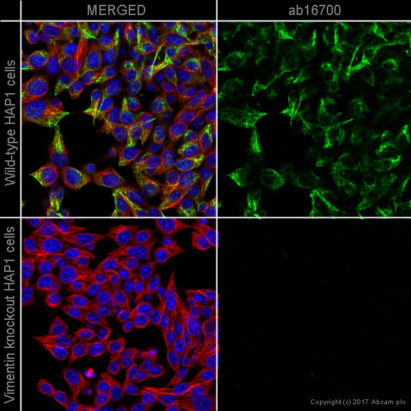Immunocytochemistry/ Immunofluorescence - Anti-Vimentin antibody [SP20] - BSA and Azide free (AB325972)
