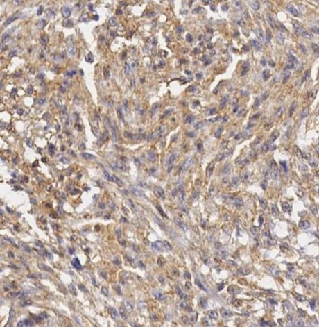 Immunohistochemistry (Formalin/PFA-fixed paraffin-embedded sections) - Anti-Vimentin antibody [SP20] - BSA and Azide free (AB325972)