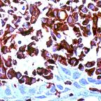 Immunohistochemistry (Formalin/PFA-fixed paraffin-embedded sections) - Anti-Vimentin antibody [SP20], prediluted (AB27608)