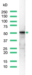 Western blot - Anti-Vimentin antibody [SP20], prediluted (AB27608)