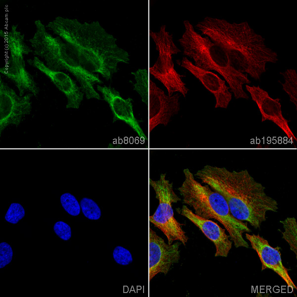 Immunocytochemistry/ Immunofluorescence - Anti-Vimentin antibody [V9] - Cytoskeleton Marker (ab8069), expandable thumbnail