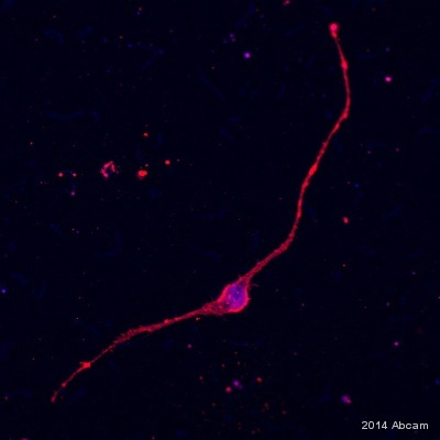 Immunocytochemistry/ Immunofluorescence - Anti-Vimentin antibody [V9] - Cytoskeleton Marker (ab8069), expandable thumbnail