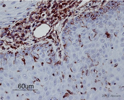 Immunohistochemistry (Formalin/PFA-fixed paraffin-embedded sections) - Anti-Vimentin antibody [V9] - Cytoskeleton Marker (ab8069), expandable thumbnail