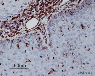 Immunohistochemistry (Formalin/PFA-fixed paraffin-embedded sections) - Anti-Vimentin antibody [V9] - Cytoskeleton Marker (AB8069)