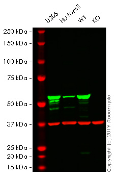 Western blot - Anti-Vimentin antibody [V9] - Cytoskeleton Marker (AB8069), expandable thumbnail