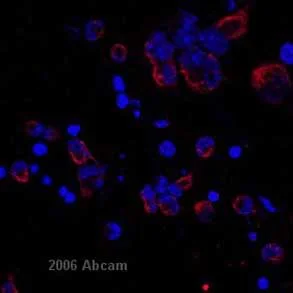 Immunocytochemistry - Anti-Vimentin antibody [VI-10] (AB20346)