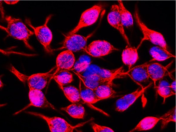 Immunocytochemistry/ Immunofluorescence - Anti-Vimentin antibody [VI-10] (ab20346), expandable thumbnail