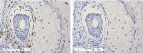 Immunohistochemistry (Formalin/PFA-fixed paraffin-embedded sections) - Anti-Vimentin antibody [VI-10] (AB20346)