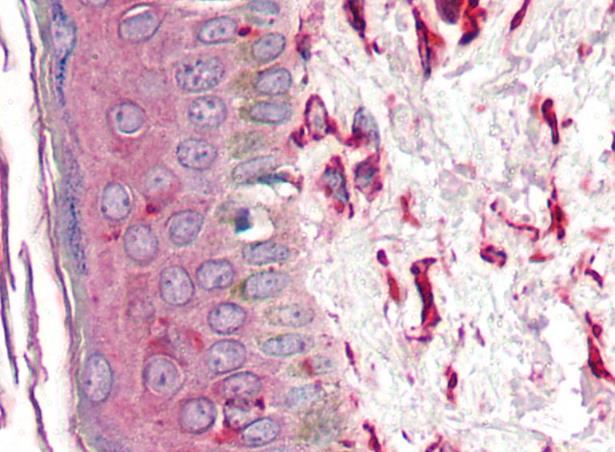 Immunohistochemistry (Formalin/PFA-fixed paraffin-embedded sections) - Anti-Vimentin antibody [VI-10] (ab20346), expandable thumbnail