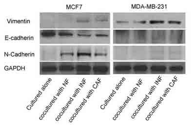 Western blot - Anti-Vimentin antibody [VI-10] (AB20346), expandable thumbnail