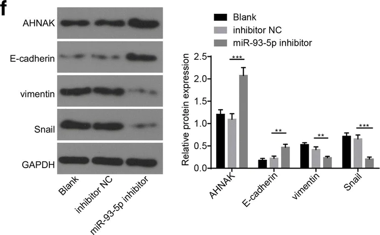 Western blot - Anti-Vimentin antibody [VI-10] (AB20346)