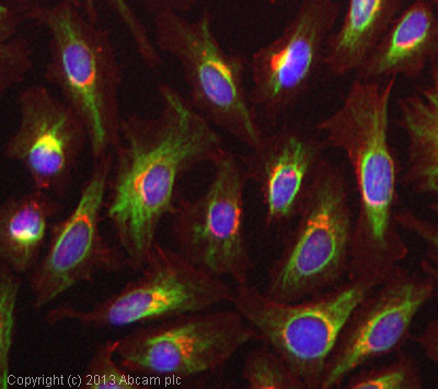 Immunocytochemistry - Anti-Vimentin antibody [VI-RE/1] (AB3974), expandable thumbnail