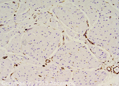 Immunohistochemistry (Formalin/PFA-fixed paraffin-embedded sections) - Anti-Vimentin antibody [VI-RE/1] (AB3974), expandable thumbnail