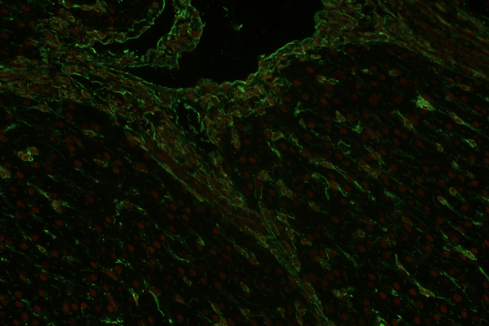 Immunohistochemistry (Formalin/PFA-fixed paraffin-embedded sections) - Anti-Vimentin antibody [VI-RE/1] (AB3974), expandable thumbnail