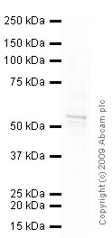 Western blot - Anti-Vimentin antibody [VI-RE/1] (ab3974), expandable thumbnail