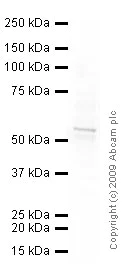 Western blot - Anti-Vimentin antibody [VI-RE/1] (AB3974)