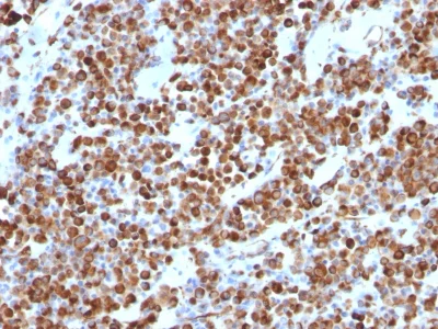 Immunohistochemistry (Formalin/PFA-fixed paraffin-embedded sections) - Anti-Vimentin antibody [VM452] - BSA and Azide free (AB212942)