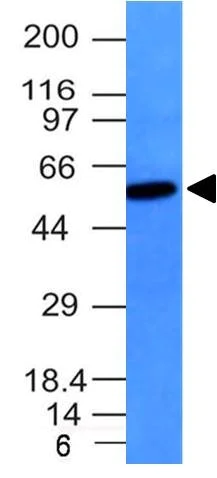 Western blot - Anti-Vimentin antibody [VM452] - BSA and Azide free (AB212942)