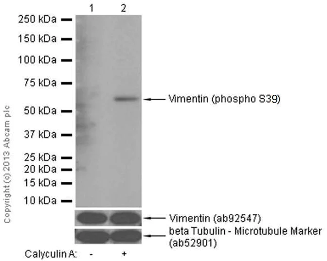 Western blot - Anti-Vimentin (phospho S39) antibody [EP1069Y] (AB52942)