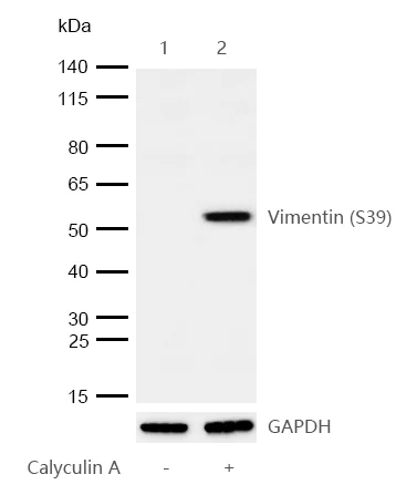 Western blot - Anti-Vimentin (phospho S39) antibody [SR1953] (AB326675)