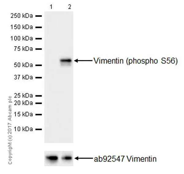 Western blot - Anti-Vimentin (phospho S56) antibody [EPR21084] (AB217673)