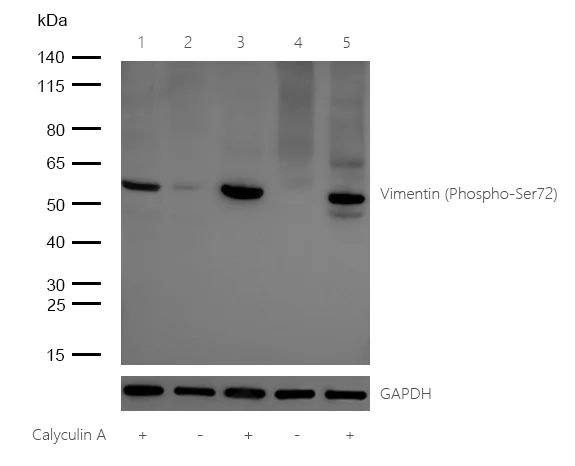 Western blot - Anti-Vimentin (phospho S72) antibody [SR1947] (AB326643)