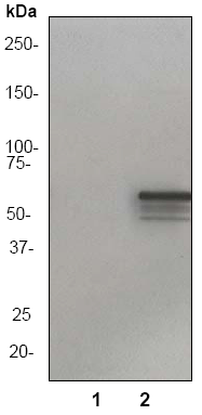 Western blot - Anti-Vimentin (phospho S73) antibody [EP1070Y] (AB52944), expandable thumbnail