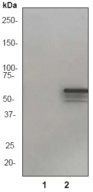 Western blot - Anti-Vimentin (phospho S73) antibody [EP1070Y] (AB52944)