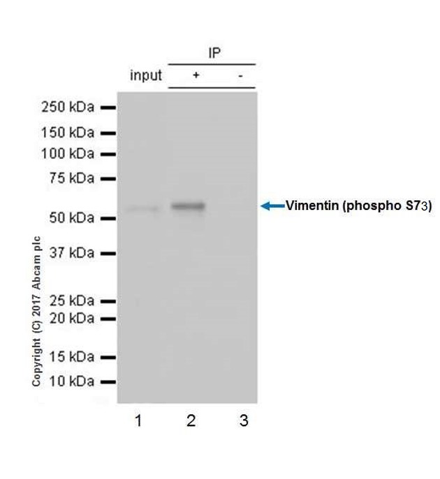 Immunoprecipitation - Anti-Vimentin (phospho S73) antibody [EP1070Y] - BSA and Azide free (AB232451)