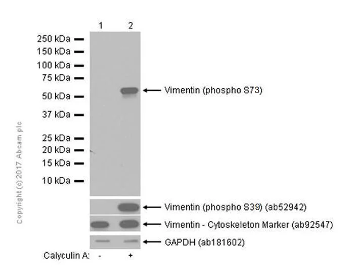 Western blot - Anti-Vimentin (phospho S73) antibody [EP1070Y] - BSA and Azide free (AB232451)
