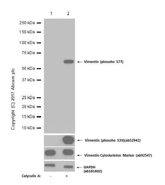 Western blot - Anti-Vimentin (phospho S73) antibody [EP1070Y] - BSA and Azide free (AB232451)
