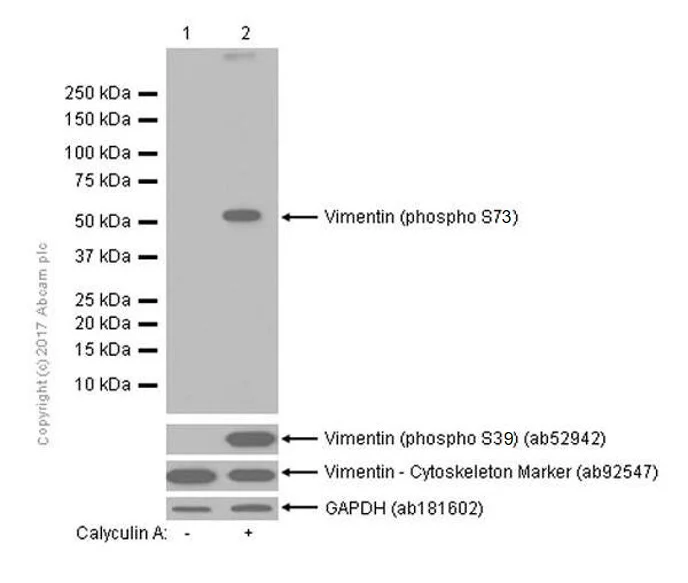 Western blot - Anti-Vimentin (phospho S73) antibody [EP1070Y] - BSA and Azide free (AB232451)
