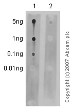 Dot Blot - Anti-Vimentin (phospho S82) antibody [EP1071Y] (AB52943)